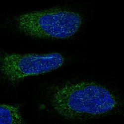 DDOST Antibody, Novus Biologicals 25 &mu;L, Unlabeled:Antibodies, Polyclonal